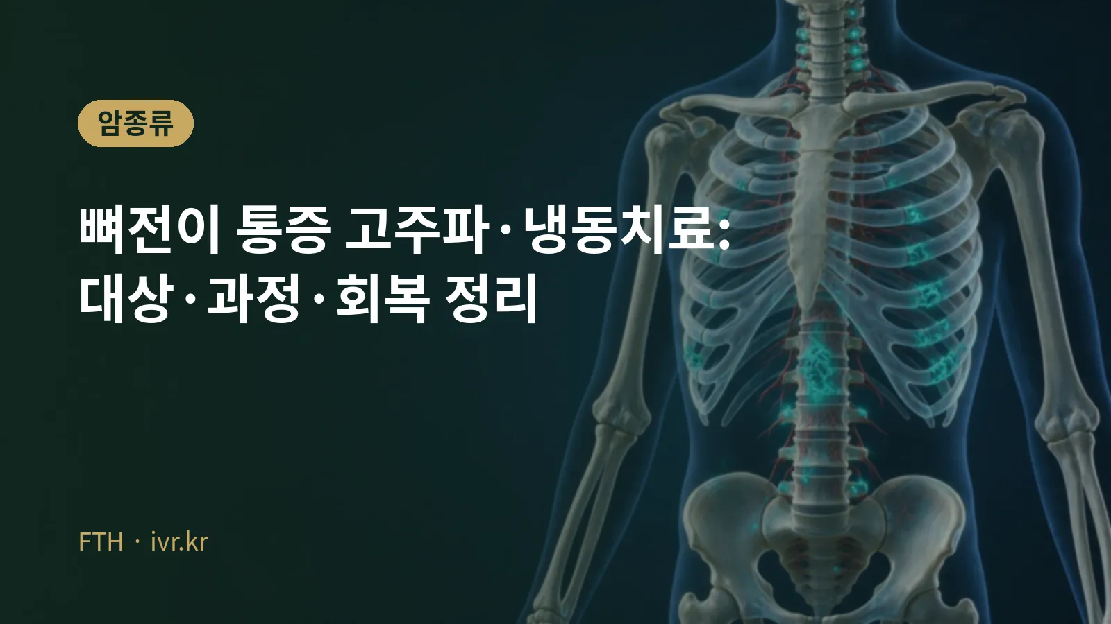 뼈전이 통증 고주파·냉동치료 안내 대표 이미지