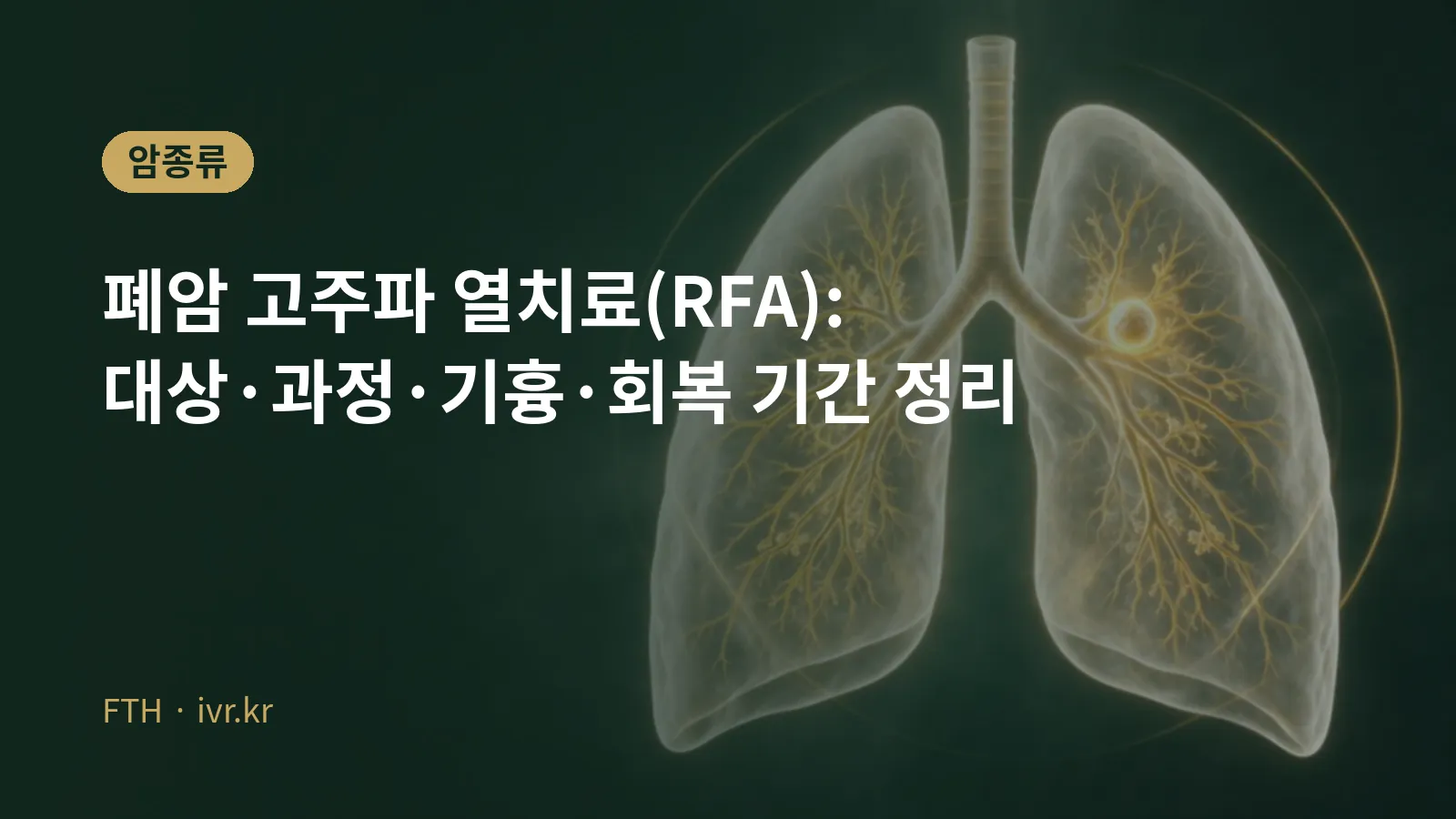폐암 고주파 열치료 과정과 회복 안내 대표 이미지
