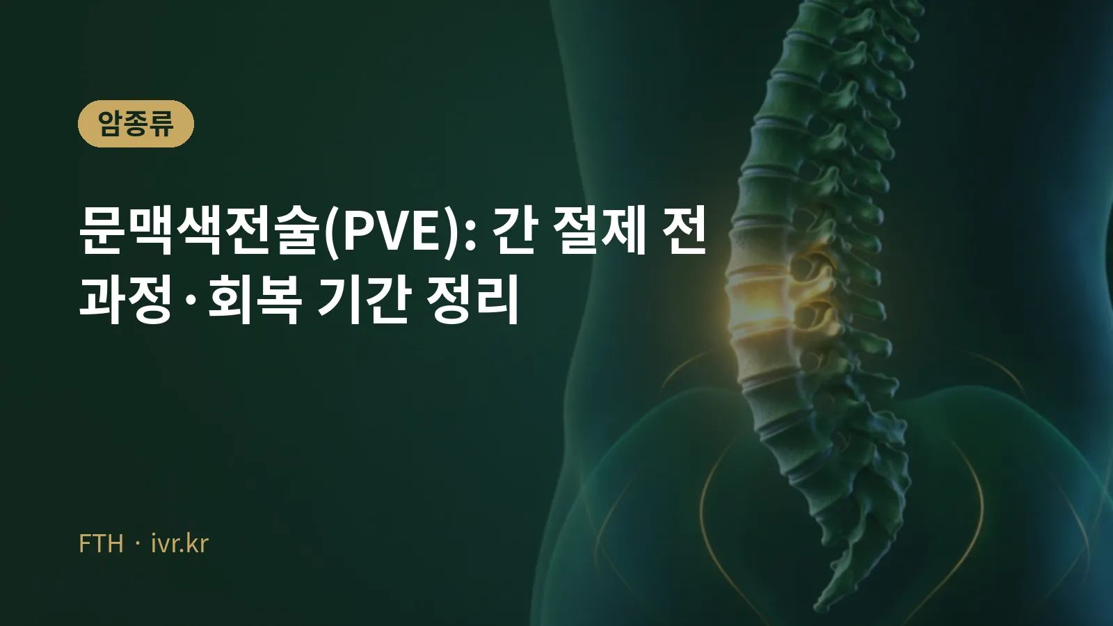 门静脉栓塞术（PVE）肝切除前治疗封面图