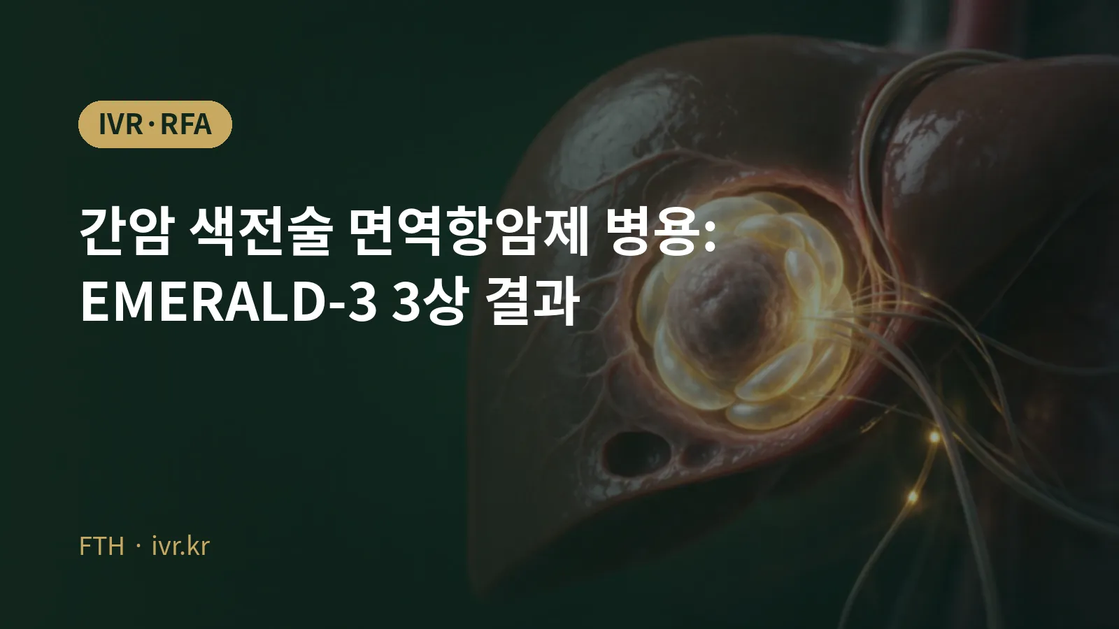 肝癌栓塞联合免疫治疗EMERALD-3结果示意图