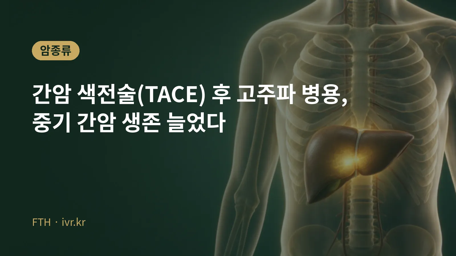 Cover image for the TORCH trial of TACE plus radiofrequency ablation in intermediate-stage liver cancer