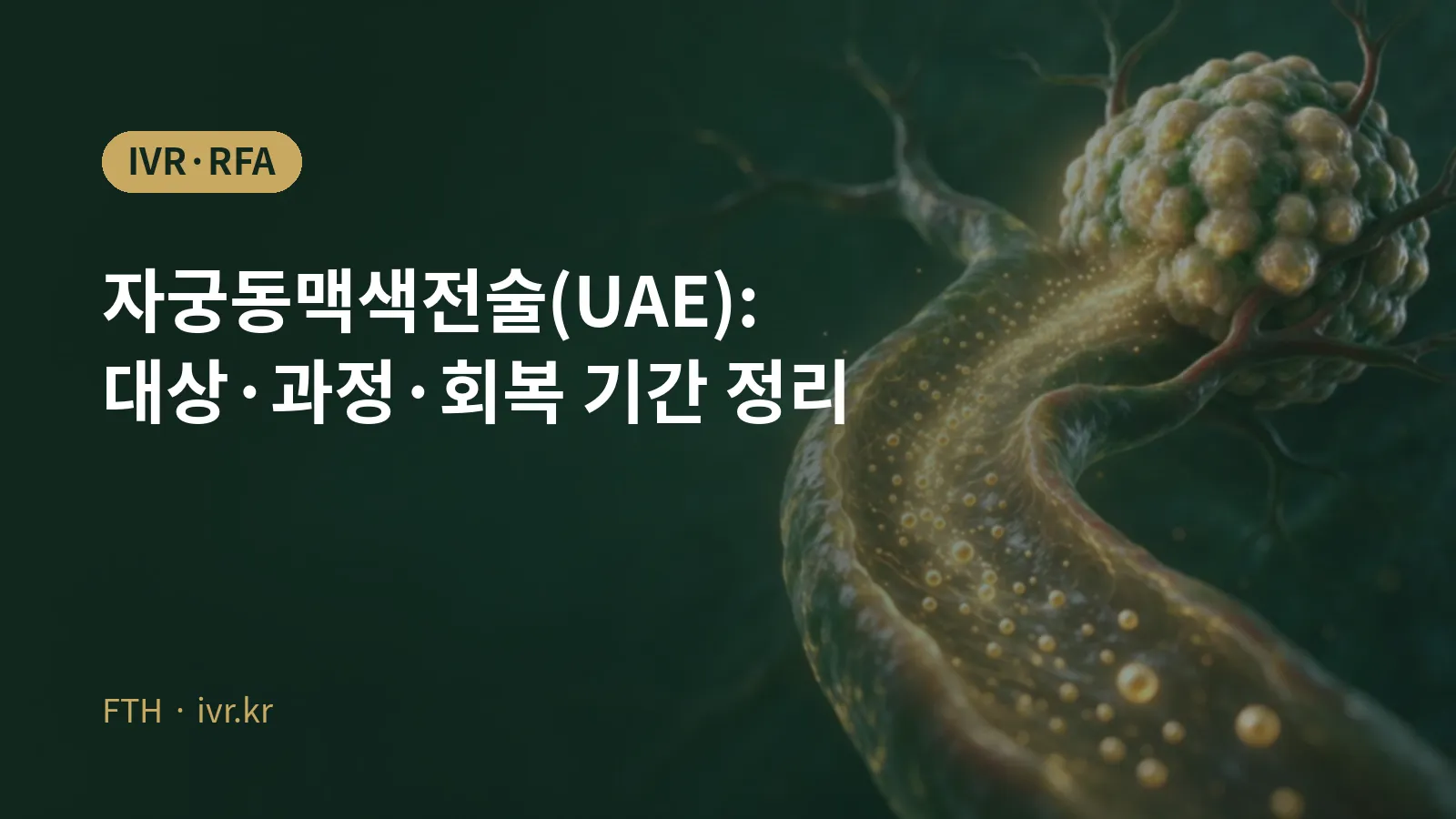 子宫动脉栓塞术UAE代表图